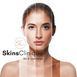 Logo van SkinsClinique